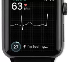 AliveCor's KardiaBand with Apple smartwatch