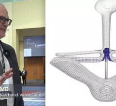 Adam Greenbaum, MD, Emory, explains the CLASP TR trial of the Pascal clip device for transcatheter repair, which was a late-breaking ACC22 study.