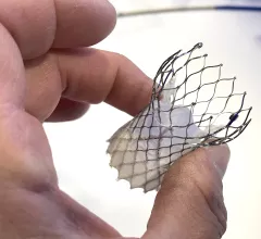 In a late-breaking long-term analysis presented at ACC 2022, the Medtronic CoreValve TAVR valve outperformed the surgical aortic valve replacement (SAVR) in terms of durability. 