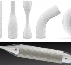 The Advanta V12 and iCast (bottom image) balloon expandable covered stents were recalled by Atrium/Getinge because the balloons may not deflate quickly when using thicker contrast for endovascular use.