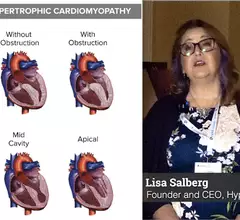 Clinical illustration showing the types of hypertrophic cardiomyopathy (HCM). Lisa Salberg, CEO of the Hypertrophic Cardiomyopathy Association (HCMA) explains how the group has helped improve HCM patient care. #HCM #Hypertrophiccardiomyopathy