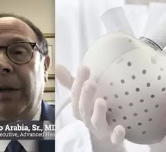 Francisco Arabia, MD, Banner Health, explains trends in total artificial hearts (TAH) in advanced heart failure patients and what is coming in new technology.