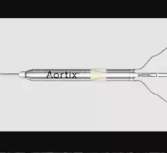 Procyrion's Aortix percutaneous mechanical circulatory support (pMCS) device targets acute decompensated heart failure (ADHF) patients with cardiorenal syndrome (CRS). 
