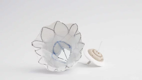 Abbott's Tendyne TMVR device | Mitral valve replacement