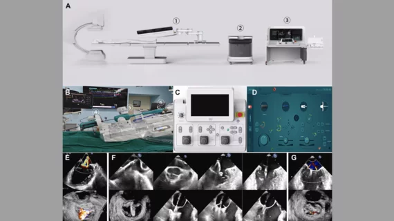 Cardiac surgeons and interventional cardiologists in China have completed the very first-in-man robot-assisted transcatheter edge-to-edge repair (TEER). It was guided entirely with echo and completed in less than 40 minutes in China. (A)Three-compartment of robotic transcatheter edge-to-edge repair (TEER) system.