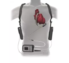 The Abbott HeartMate 3 left ventricular assist system. When Medicare updated its policy on left ventricular assist devices (LVADs) in 2020, making it easier for heart failure patients to receive an LVAD at a health center that does not perform heart transplants, the change was designed to improve patient access and boost outcomes. However, new research published in JAMA Network Open suggests shift may have potentially caused patients to miss out on heart transplants they would have otherwise received.