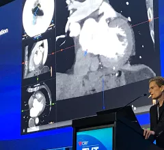 A structural heart Presentation during the TVT 2022 conference. #TCT #TCT22 #TCT2022