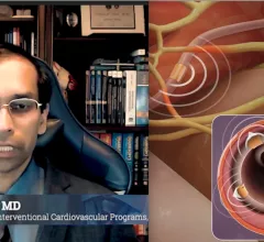 Deepak Bhatt, MD, discusses the long-term, positive SYMPLICITY HTN-3 trial results presented at TCT 2022, and the future of renal denervation therapy to treat hypertension. #TCT