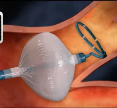 Medtronic’s Arctic Front cryoballoon catheters