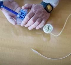 The Minima Stent being demonstrated by Cedars Sinai Hospital. The adjustable stent is designed to grow with children who need cardiac procedures. 