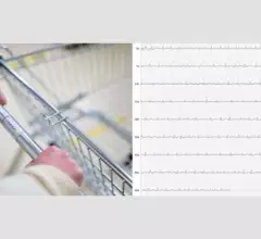 Shopping Cart ECG electrocardiogram AFib atrial fibrillation