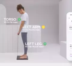 Withings Body Scan Connected Health Station FDA cleared