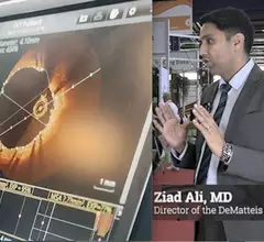 Ziad Ali, MD, explains the ILUMIEN IV trial results for OCT Vs. Angiography.