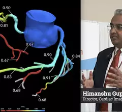Himanshu Gupta, MD, explains use of FFR-CT in daily practice at Valley Health System, New Jersey at SCCT 2023. #FFRCT #Heartflow #SCCT #SCCT23 #SCCT2023