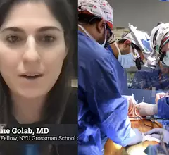 Stephanie Golab, MD, NYU Grossman School of Medicine, explains statistics on heart transplant outcomes in older adults