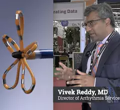 Vivek Reddy, MD, director of arrhythmia service and processor of medicine in cardiac electrophysiology, Mt. Sinai, New York, expolains the key takeaways from the ADVENT trial of pulsed field ablation at ESC 2023.