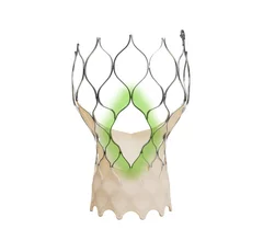 Medtronic has received U.S. Food and Drug Administration (FDA) approval for its Evolut FX+ transcatheter aortic valve replacement (TAVR) system for the treatment of symptomatic severe aortic stenosis. 
