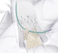 Medtronic's Evolut Pro TAVR valve is designed to treat aortic stenosis.
