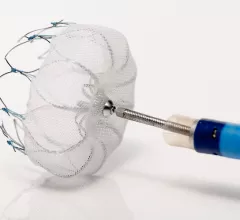 The Boston Scientific Watchman device is a transcatheter device implanted in the left atrial appendage (LAA) to seal it off so atrial fibrillation patients can got off of anticoagulant therapy.