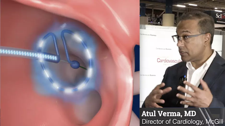 Atul Verma explains thne results of the PULSE-AF trial at ACC23.