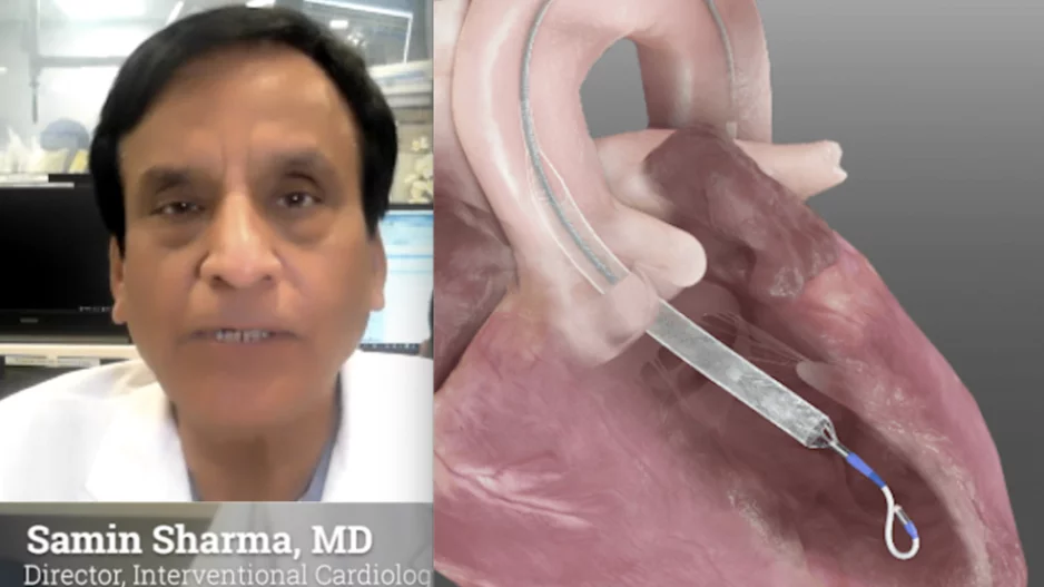Samin Sharma, MD, director of interventional cardiology and director of clinical cardiology, Mount Sinai Hospital, New York, discusses the first-in-human use of the Magenta Elevate percutaneous left ventricular assist device (pLVAD) with a small 10 French size and 5.5 liters per minute of hemodynamic support.