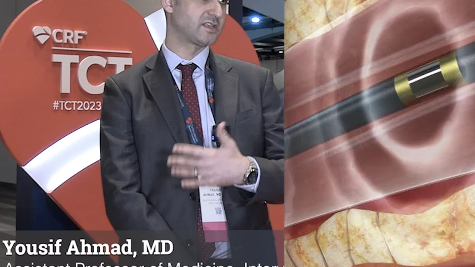 Video of Yousif Ahmad, MD, Yale, discussing IVL advances and increased reinbursements
