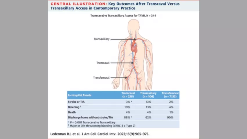 Transcatheter aortic valve replacement (TAVR) procedures performed using transcaval or transaxillary access are associated with more complications than transfemoral TAVR, according to a new study published in JACC: Cardiovascular Interventions.