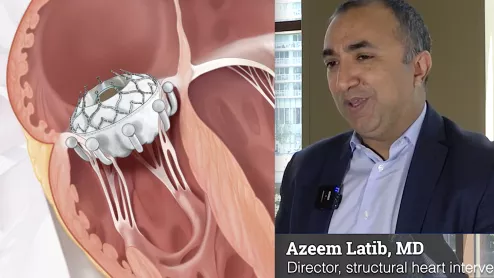 Azeem Latib explains advances in transcatheter mitral and tricuspid valve therapies at TVT 2022. #TVT #TVT22 #TVT2022 #TMVR #TTVR 