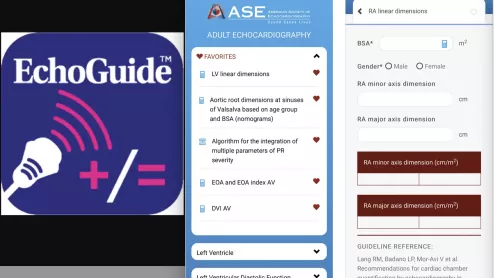 The American Society of Echocardiography (ASE) launched its new, interactive EchoGuide mobile and web application for healthcare professionals last week, and the society said it already has about 15,000 downloads.