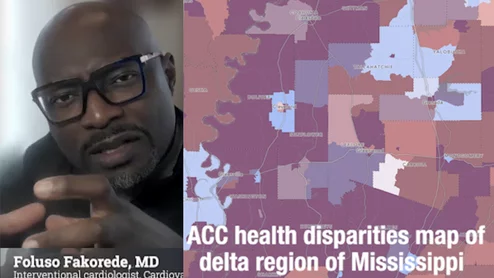 Cardiologist Foluso Fakorede, MD, explains the most common health disparities he sees preventing care in rural Mississippi. #PADadvocate #PAD #CLI #CLTI #Healthdisparities #HealthdisparitiesMS