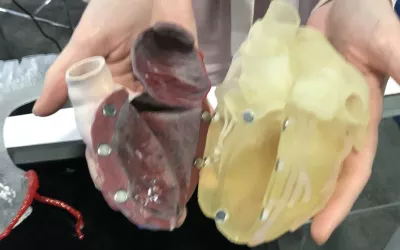 A 3D printed heart used in a congenital heart case to help navigate complex anatomy shown by the 3D printing vendor Axial 3D.