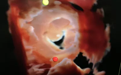 The mitral valve visualized by a a GE NuVision 4D intra-cardiac echo (ICE) catheter a life-like surgical rendering technology on the Vivid E95 cardiac ultrasound system. The catheter was co-developed with Biosense Webster to perform EP procedures. It also can be used in place of TEE in structural heart procedures to eliminate the need for an interventional echocardiography.  #ACC22