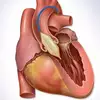 Balloon valvuloplasty months after implantation is a safe and effective treatment option for patients with transcatheter heart valve (THV) dysfunction, according to a new analysis published in the Journal of the American College of Cardiology