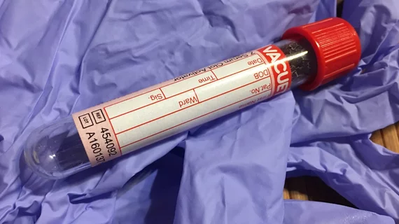 Blood Test Tube