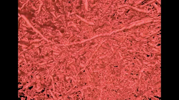 The new imaging method VascuViz includes a quick-setting polymer mixture to fill blood vessels and make them visible in multiple imaging techniques. It enables visualization of the structure of a tissue’s vasculature, which in conjunction with detailed mathematical models or complementary images of other tissue elements can clarify the complex role of blood flow in health and disease. Watch a video example of this technology