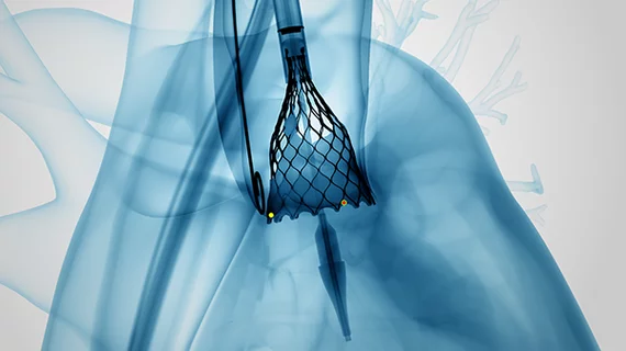 Transcatheter aortic valve replacement (TAVR) patients continue to benefit from an optimized pre- and post-procedural treatment strategy that utilizes the cusp overlap technique and the Evolut Pro and Pro+ TAVR valves, according to new findings presented at EuroPCR 2022 in Paris. 