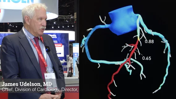 James Udelson, MD, from Tufts and an investiogator in the PRECISE trial, explains how FFR-CT combined with coronary CT outperformed the standard of care in patients with stable chest pain, or low-risk patients with suspected coronary involvement.