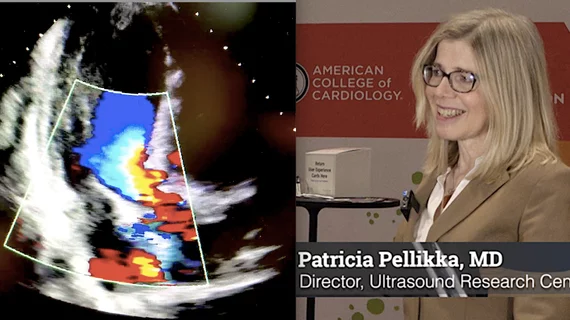 Echocardiography expert Patricia A. Pellikka, MD, discussed the trend of increasing artificial intelligence (AI) integration in cardiac ultrasound with Cardiovascular Business at American College of Cardiology (ACC) 2023 meeting.