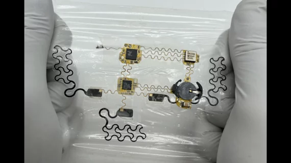 E-tattoo chest heart monitor designed by engineers with the University of Texas at Austin