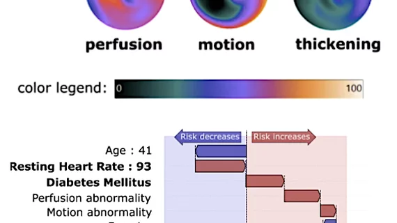 Part of the graphical results from the Cedars-Sinai AI cardiac risk assessment tool from basic data like the patient’s age, gender, weight, heart rate, and blood pressure, and AI interpretation of cardiac imaging.