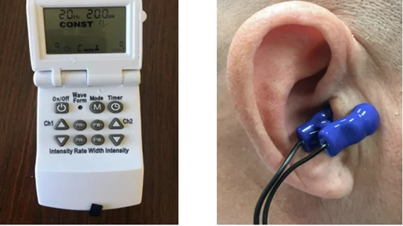 Ear-clip device offers non-pharmacological treatment for postural tachycardia syndrome (POTS). #HRS2023 #HRS
