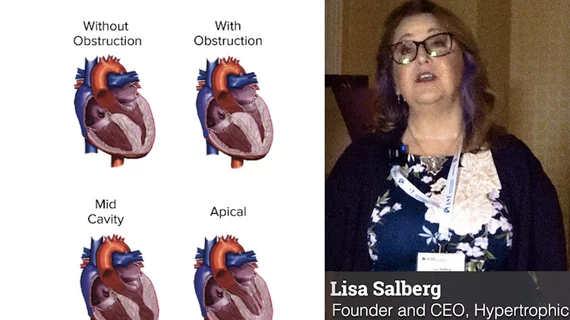 Clinical illustration showing the types of hypertrophic cardiomyopathy (HCM). Lisa Salberg, CEO of the Hypertrophic Cardiomyopathy Association (HCMA) explains how the group has helped improve HCM patient care. #HCM #Hypertrophiccardiomyopathy