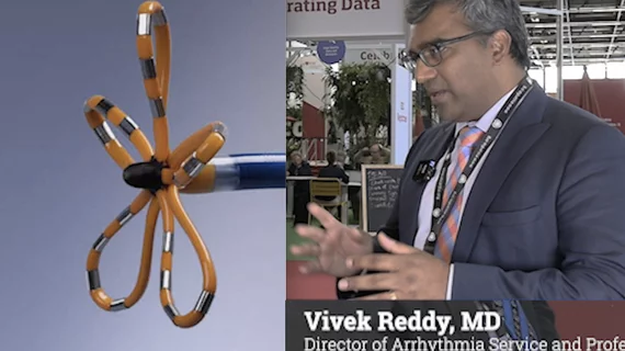 Vivek Reddy, MD, director of arrhythmia service and processor of medicine in cardiac electrophysiology, Mt. Sinai, New York, expolains the key takeaways from the ADVENT trial of pulsed field ablation at ESC 2023.