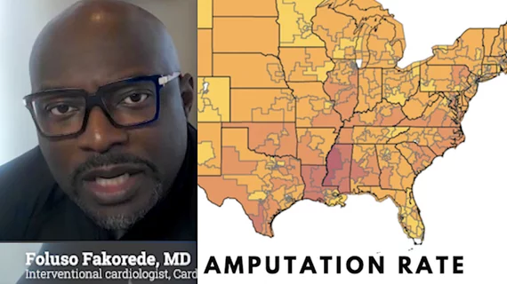 Foluso Fakorede, MD, interventional cardiologist, Cardiovascular Solutions of Central Mississippi, explains how he moved to rural Mississippi, the epicenter of the PAD and CLI epidemic, to open a practice to take action and reverse the glaring health disparities and that are leading to more than 400 leg amputations per day in the U.S.