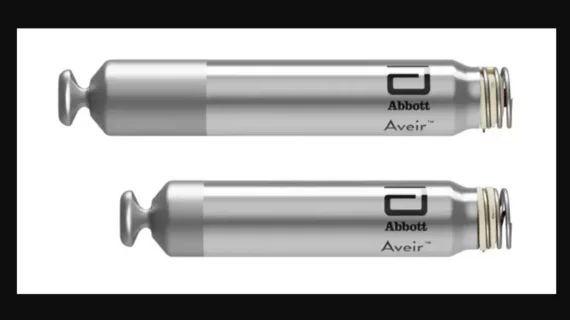 Abbott’s Aveir DR leadless pacemaker, the world’s very first dual-chamber pacing solution of its kind, is associated with a “reliable” performance after six months, according to new data published in Heart Rhythm.[1]